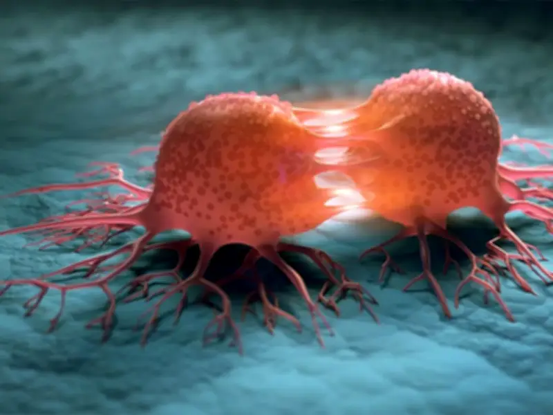 نظام ياباني ذكي للكشف عن سرطان عنق الرحم باستخدام الذكاء الاصطناعي