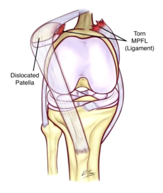 الشهراني يكشف تفاصيل إصابة حمد اليامي في مباراة الهلال والتعاون
