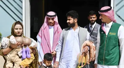 توأم باكستاني ملتصق يصل الرياض بتوجيهات القيادة لتقييم إمكانية الفصل الطبي