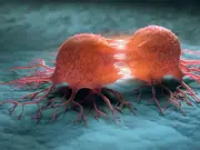 نظام ياباني ذكي للكشف عن سرطان عنق الرحم باستخدام الذكاء الاصطناعي