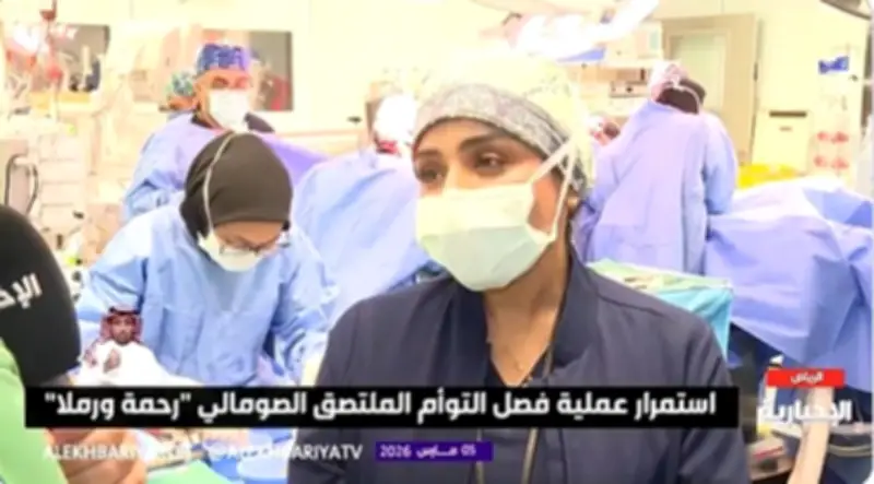 استشارية جراحة الأطفال تكشف تفاصيل معقدة لعملية فصل التوأم الصومالي