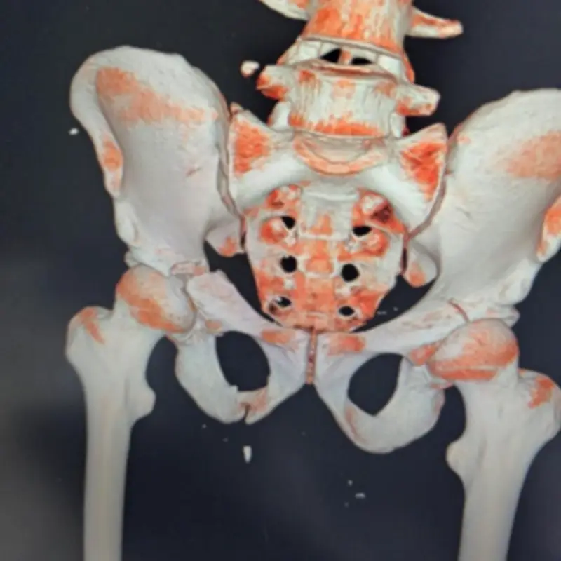 فريق طبي بمستشفى المانع ينقذ مريضاً من الموت بعد سقوطه من الدور الثالث