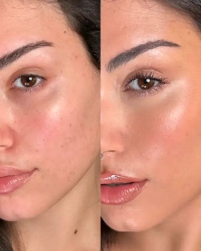 تحول عالم المكياج: من التغطية الكاملة إلى الجمال الطبيعي في 2026