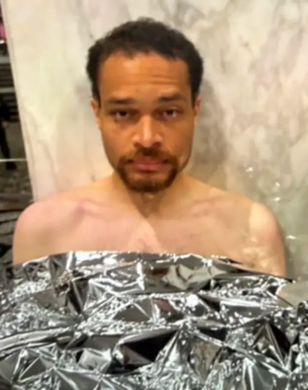 مطلق النار في حادثة عشاء البيت الأبيض: لا أتوقع الصفح