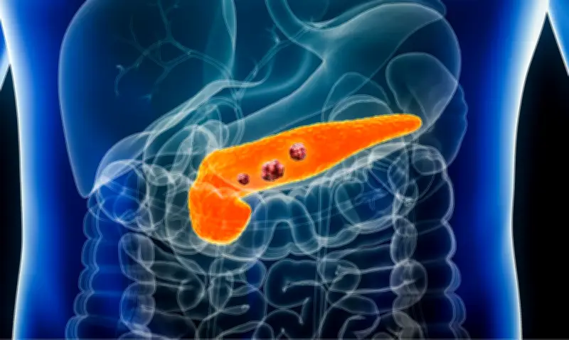 القاتل الصامت: سرطان البنكرياس وأسباب خطورته المميتة في عالم الطب