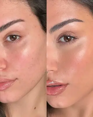 تحول عالم المكياج: من التغطية الكاملة إلى الجمال الطبيعي في 2026