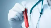 فحص دم جديد يتنبأ بخطر الفشل الكلوي قبل سنوات لدى حاملي طفرات APOL1