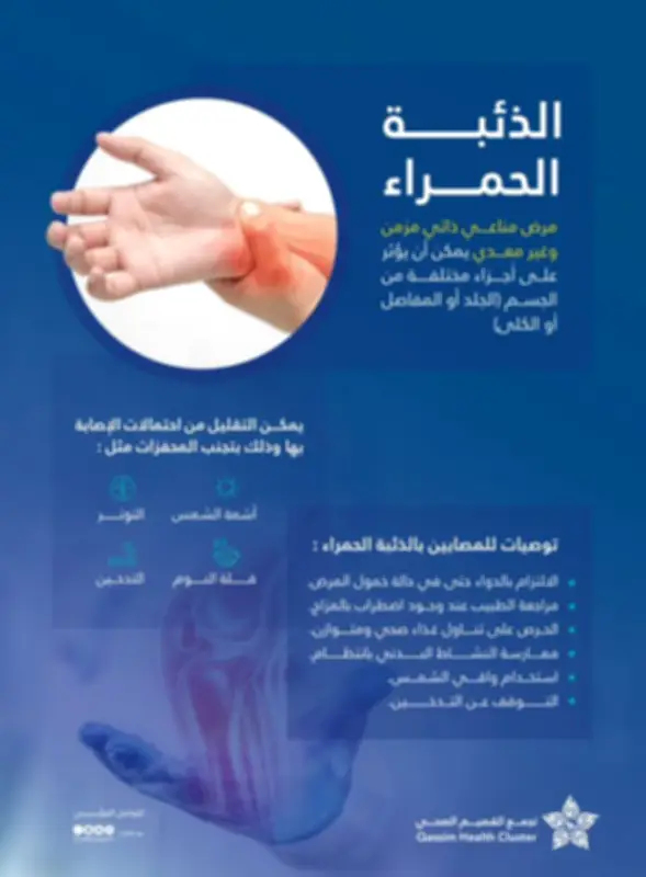 تجنب 4 محفزات رئيسية للذئبة الحمراء للتعايش مع المرض