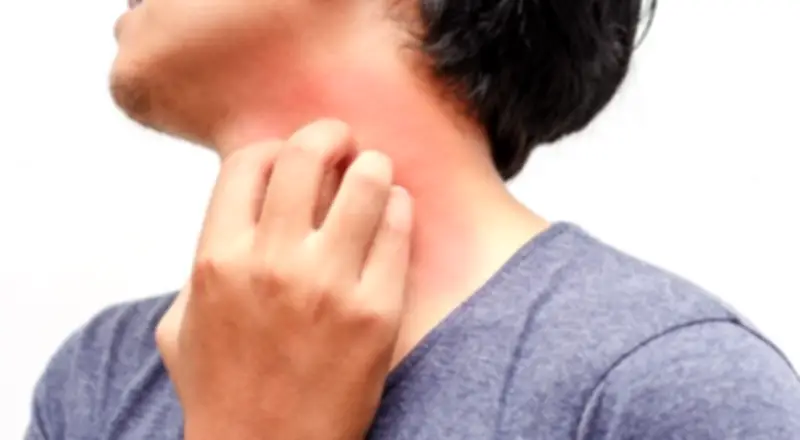دراسة تكشف سبب كون حكة الوجه أشد ألماً من باقي الجسم
