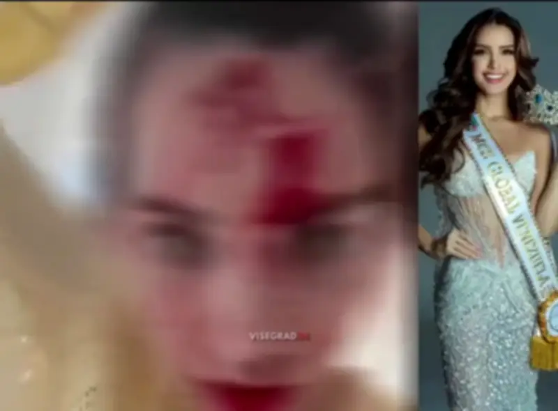 اعتداء عنيف على ملكة جمال فنزويلا في فندق خلال مهرجان كان