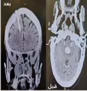 وزارة الصحة تطلق حملة توعوية للوقاية من السكري