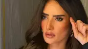 سجن المتهمين بإصابة طفلي زينة بكلب شرس في الشيخ زايد