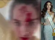 اعتداء عنيف على ملكة جمال فنزويلا في فندق خلال مهرجان كان