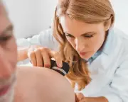 سرطان الجلد القاتل يسجل أرقاماً قياسية في المملكة المتحدة