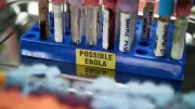 تحذير أممي من تفشي إيبولا في الكونغو وأوغندا يتجاوز قدرات الاستجابة