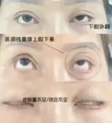 ضحية تجميل في الصين تواجه غرامة 400 ألف يوان بسبب شرط جزائي