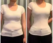 هل تمنح عملية قص الأضلاع خصراً أصغر؟ مخاطر وتحديات