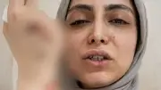 اعتداء على طبيبة أسنان في شبرا الخيمة.. كسر مضاعف وصراخ ودماء