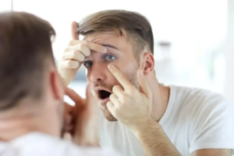 كيف تتخلص من احمرار العين ومتى يستدعي زيارة الطبيب؟