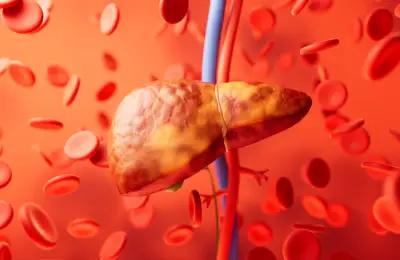 خبراء يحذرون: أطعمة تدمر الكبد و1.8 مليار معرضون للخطر بحلول 2050